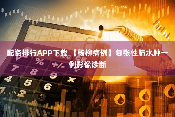 配资排行APP下载 【杨柳病例】复张性肺水肿一例影像诊断
